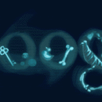 xraydiscovery2010-Google-Doodle